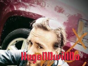 HugeNDwillDo