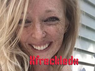 Xfreckledx